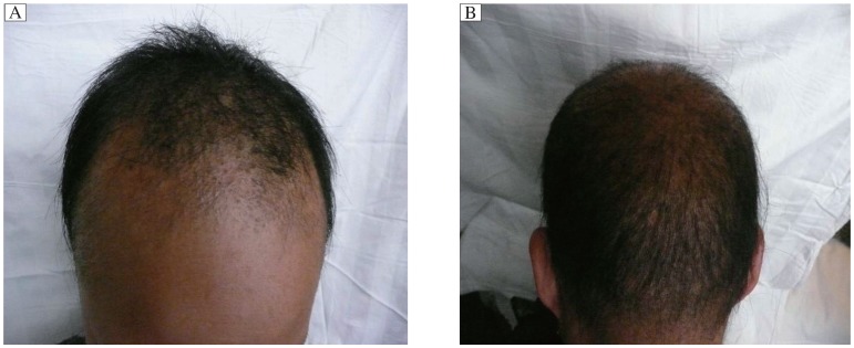 Fig.1