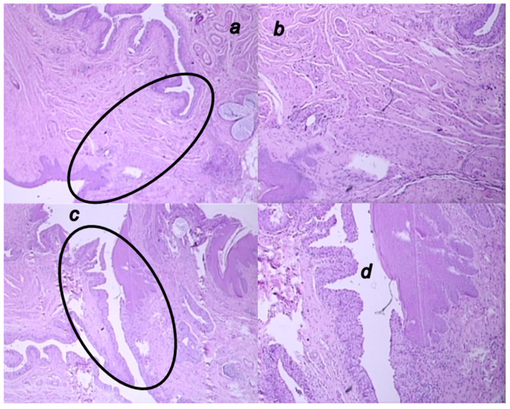 Figure 14