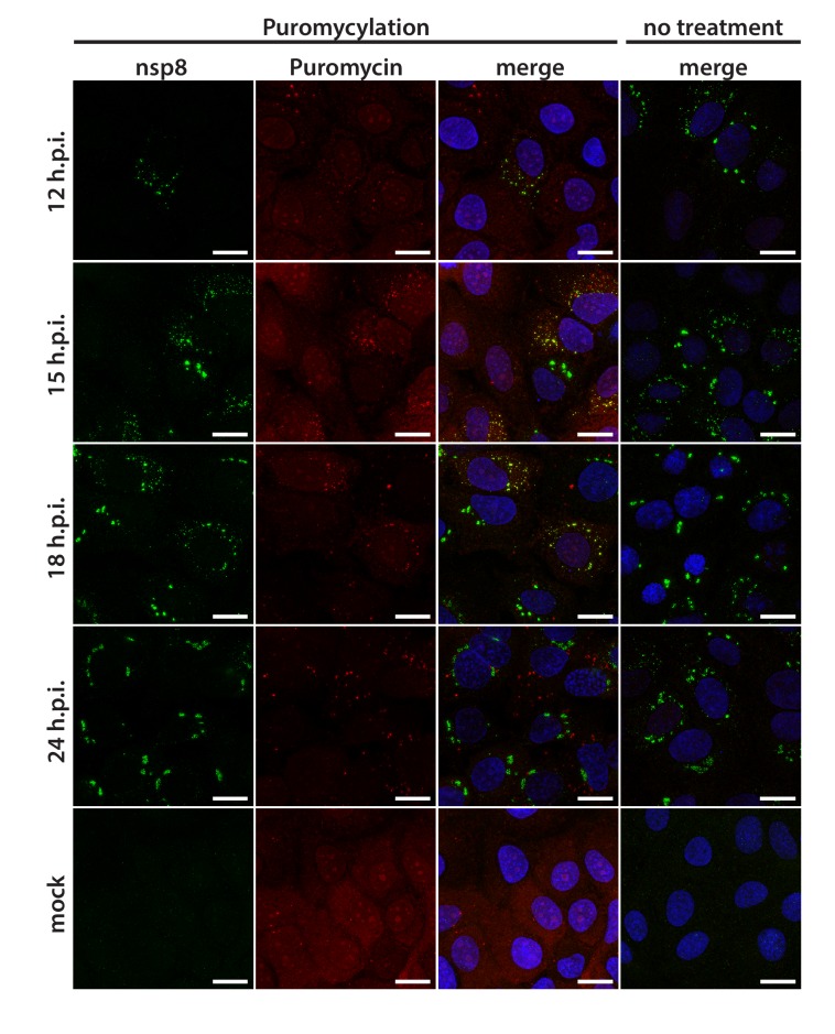 Figure 7—figure supplement 1.