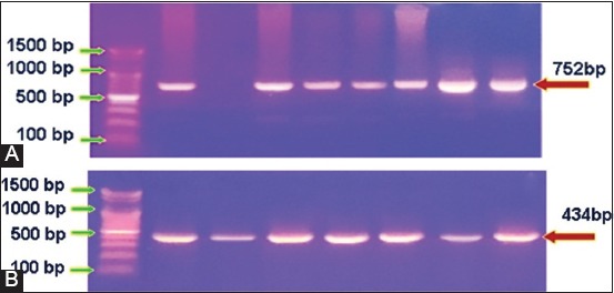 Figure-4