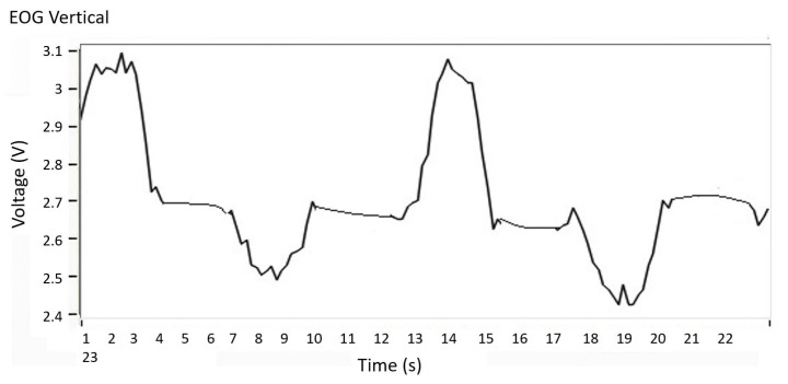 Figure 14