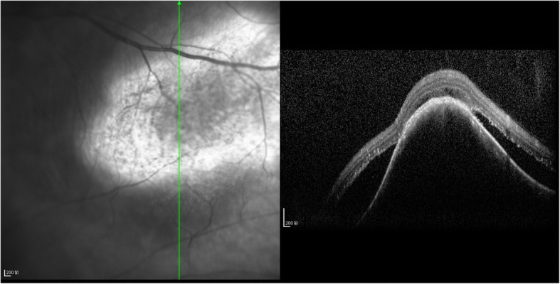 Fig. 2