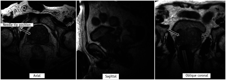 Fig. 12