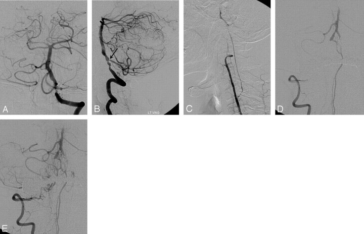 Fig 4.