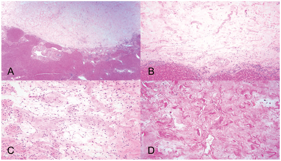 Figure 11.