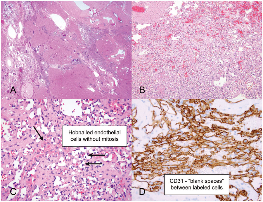 Figure 12.