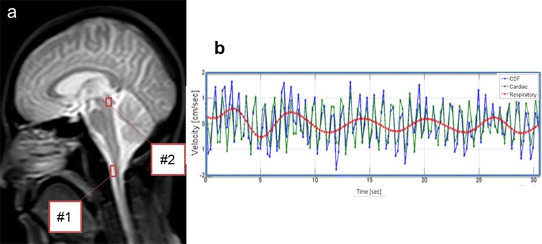 Fig. 1