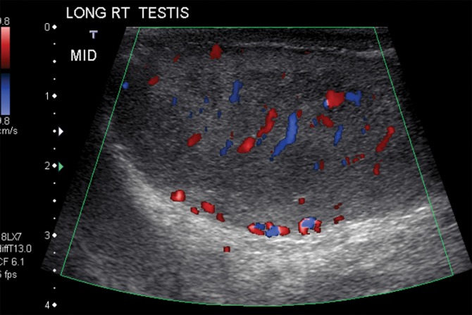 Figure 15b.