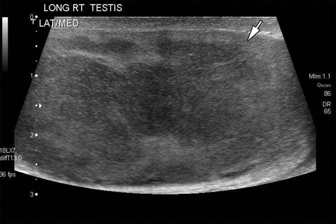 Figure 15a.