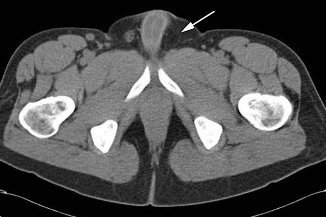 Figure 1b.