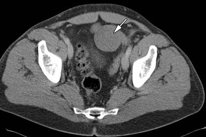 Figure 1c.