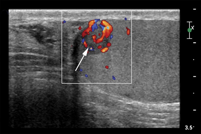 Figure 13b.