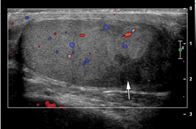 Figure 7b.