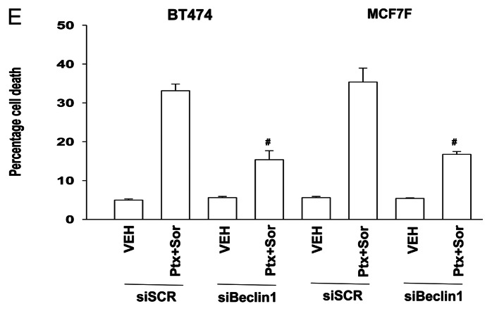 Figure 1E. 