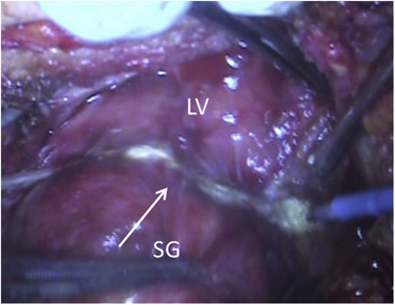 Figure 3