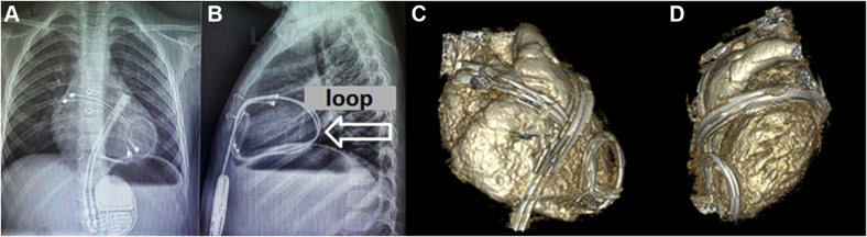 Figure 4