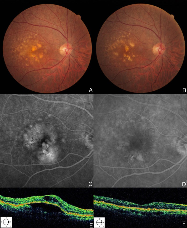 Fig. (1)