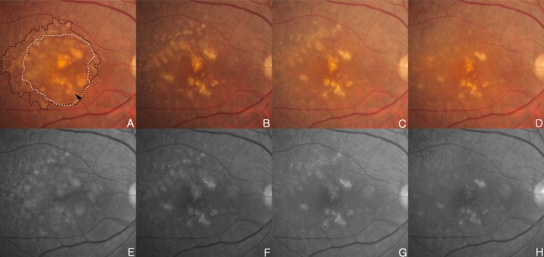 Fig. (2)