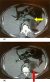 Picture 1