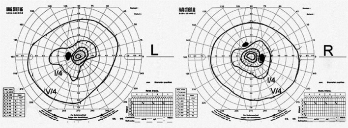 Fig. 1