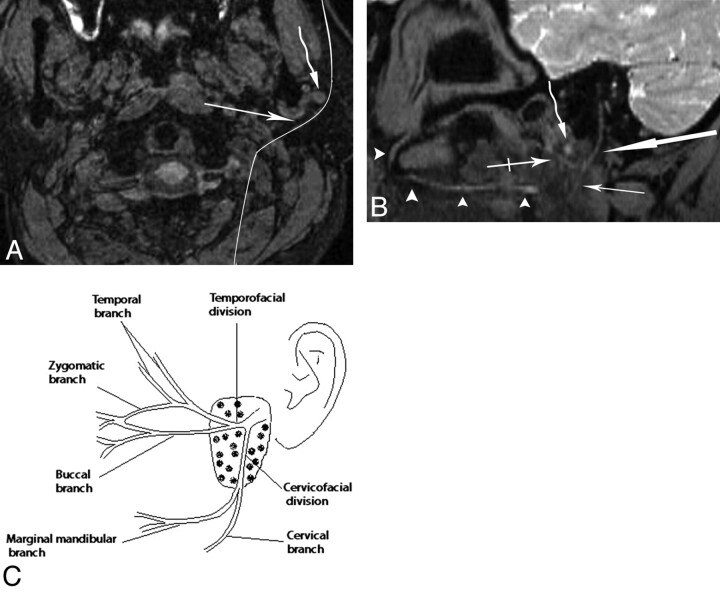 Fig 4.