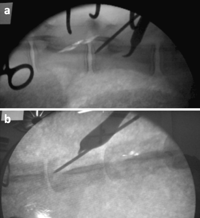 Fig. 2