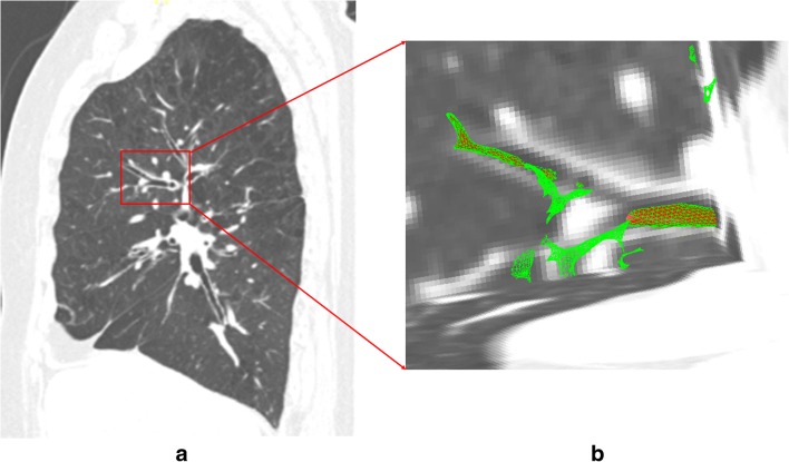 Fig. 7