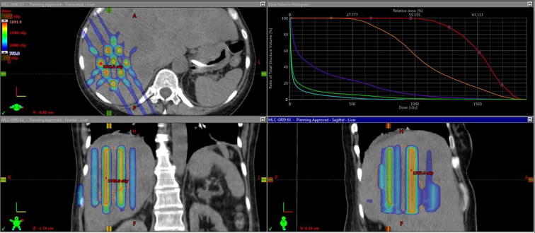 Fig. 2