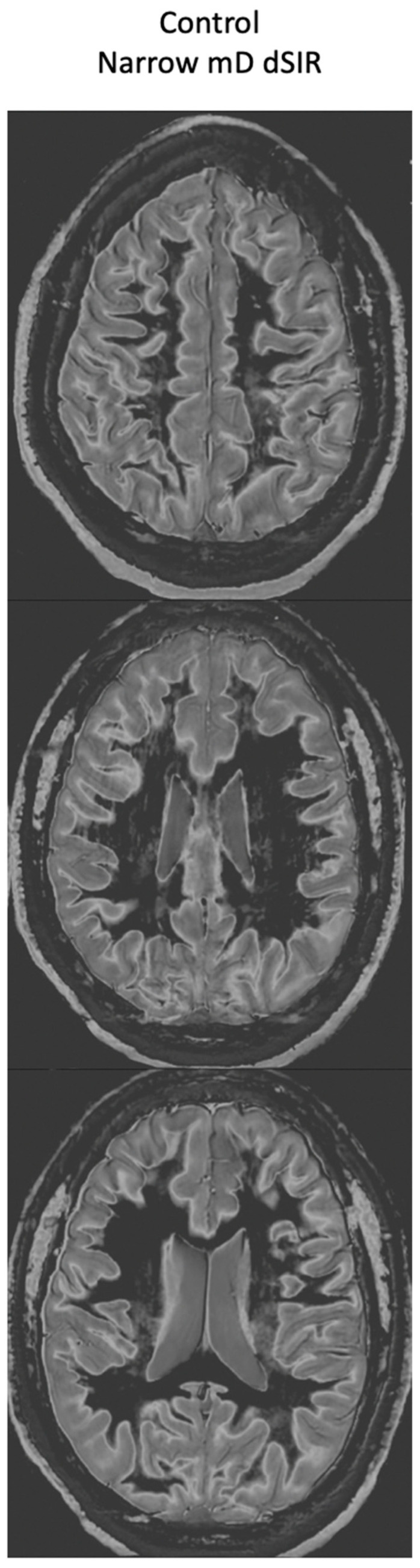 Figure 16