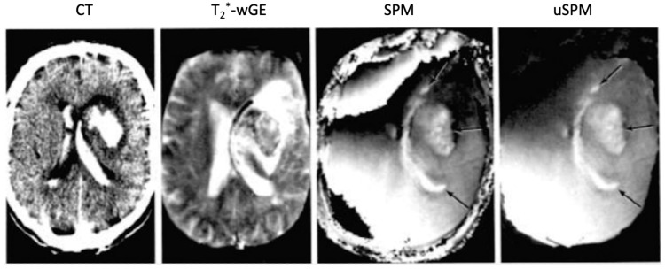 Figure 10