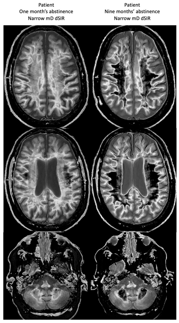 Figure 19