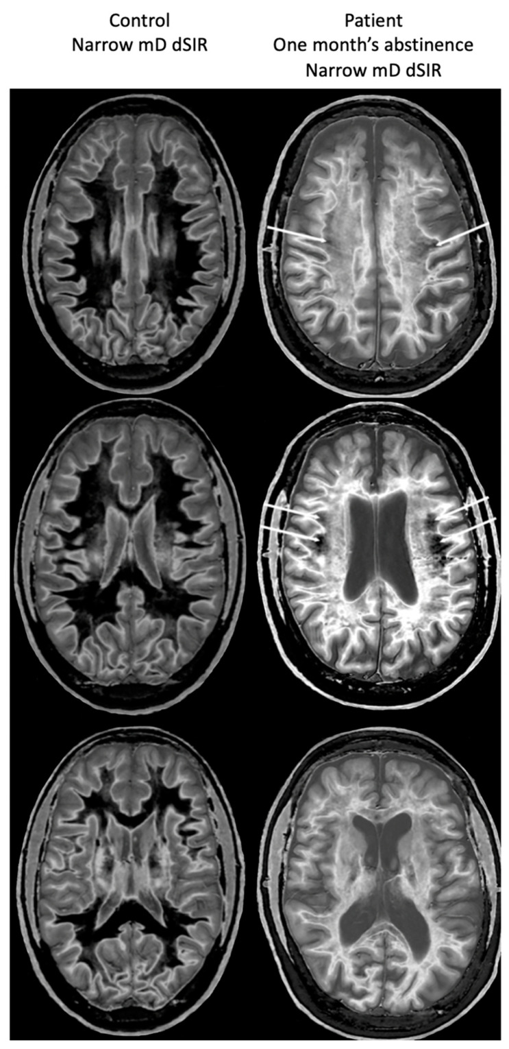 Figure 17