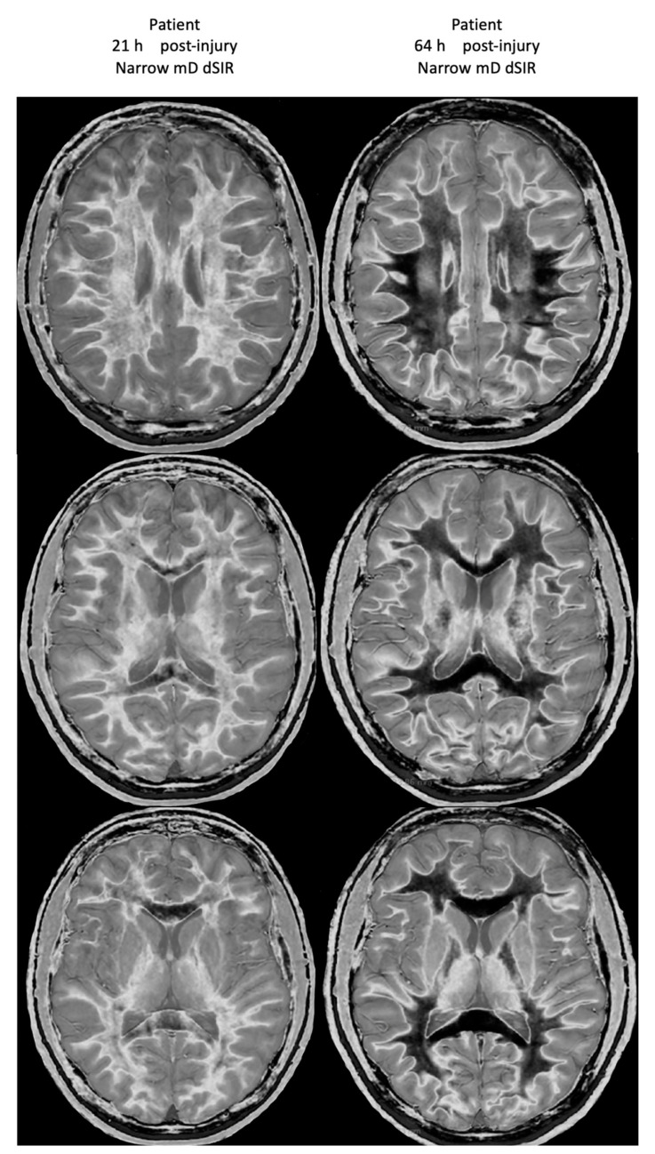 Figure 21