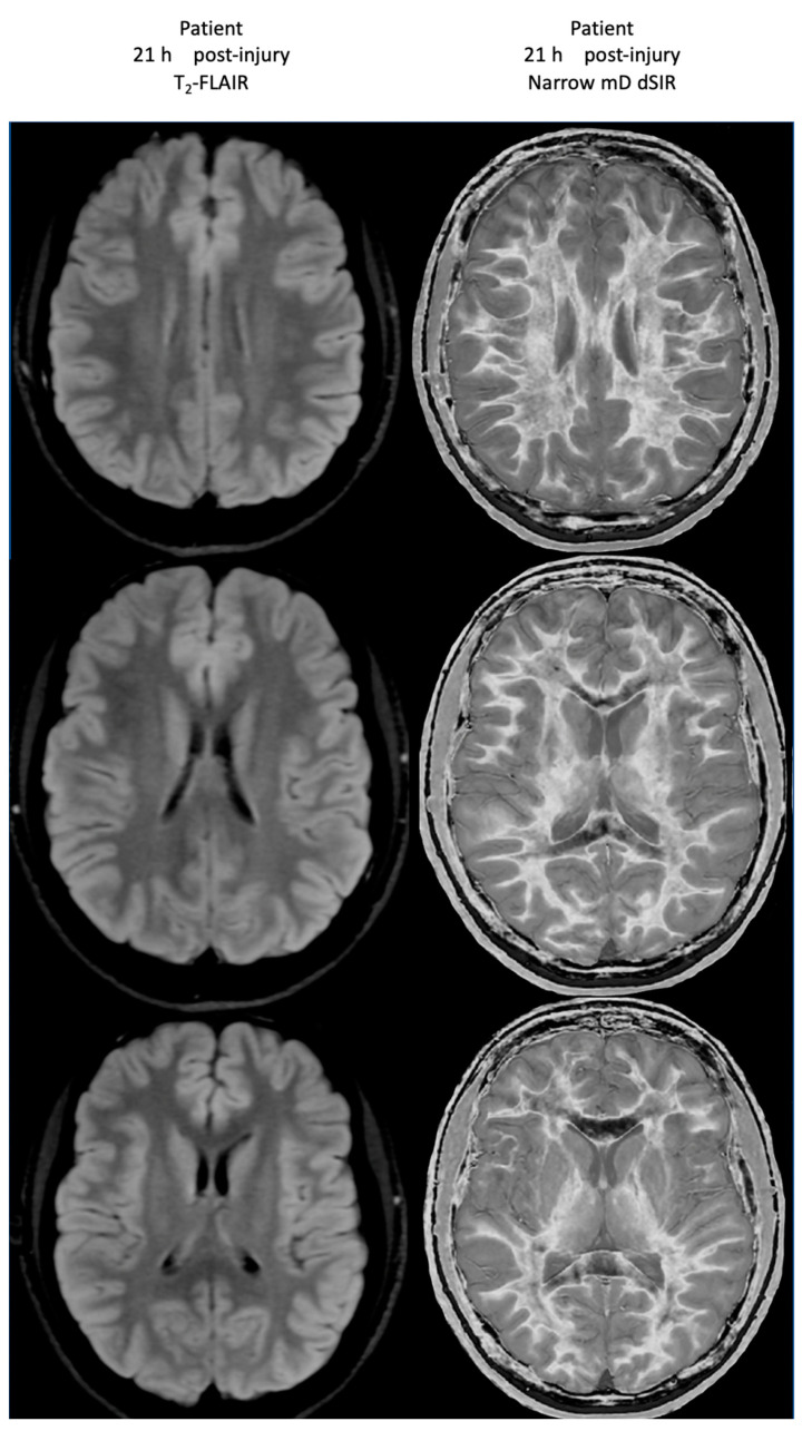 Figure 20