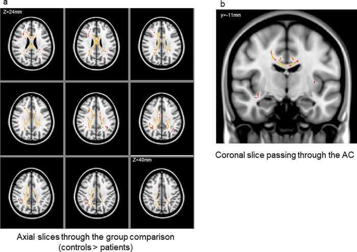 Fig 12