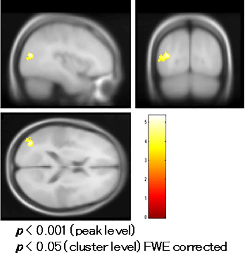 Fig 5