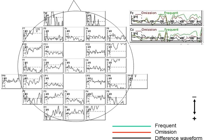 Fig 2