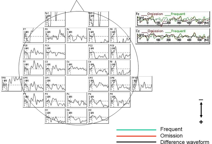 Fig 3