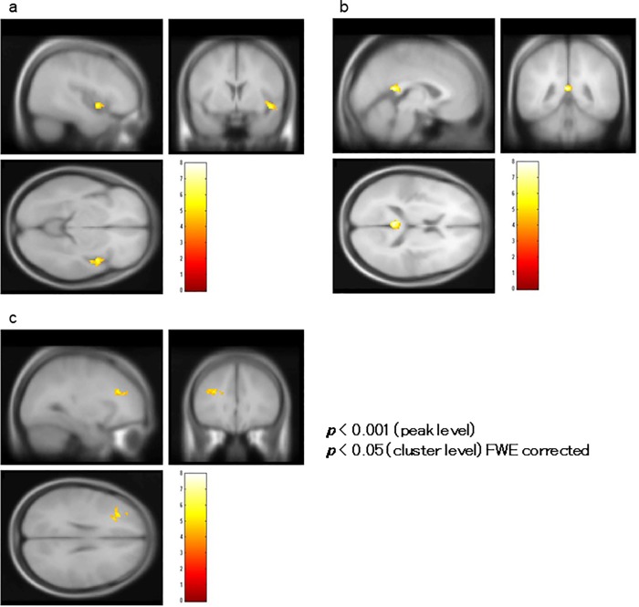 Fig 11