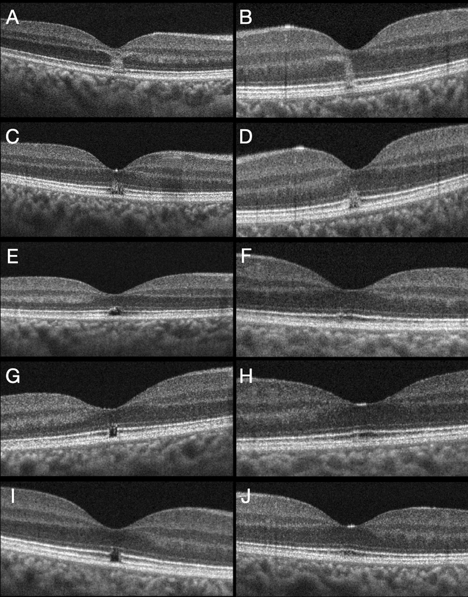 Fig. 2