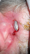 Figure 38