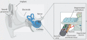 Figure 41