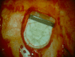 Figure 37