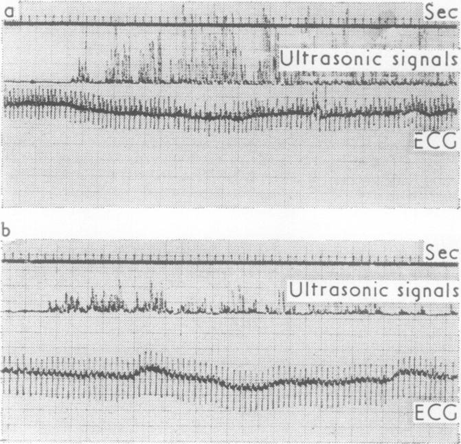 graphic file with name thorax00129-0030-a.jpg