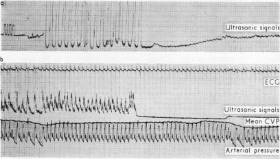 graphic file with name thorax00129-0029-a.jpg