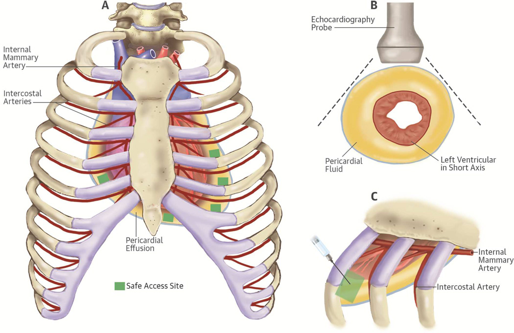 Central Illustration