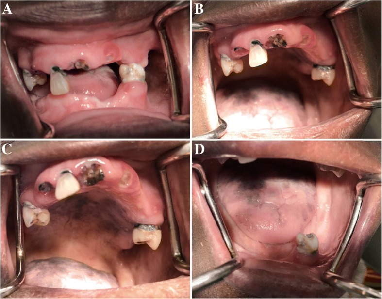 Fig. 1