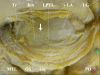 Fig. (1)