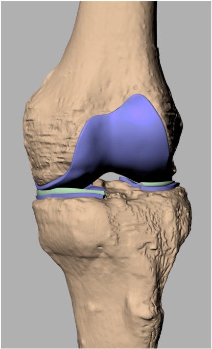 Fig. (1)