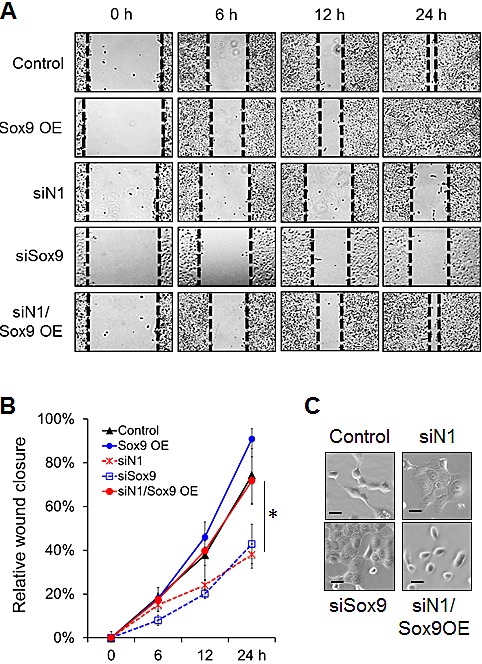 Figure 5: Sox9 mediates Notch1-induced cell migration and morphological changes